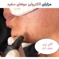 لیزر مو زائدآقاخانم(کل بدن رایگان) شعبه دوم