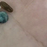 سنگ مهره اصلی