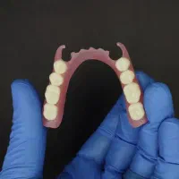 پروتز متحرک دندانی
