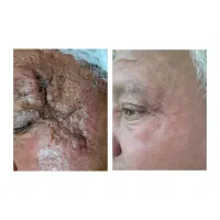 انجام کلیه خدمات پوست تضمینی
