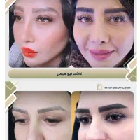 تور خدمات و جراحی زیبایی|خدمات آرایشگری و زیبایی|گرگان, |دیوار