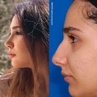 تخفیف 50%|خدمات زیبایی و سلامت|کرمانشاه, |دیوار