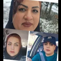 لیفت صورت ،شقیقه،گونه ،جراحی بینی ،تخفیف تابستان|خدمات زیبایی و سلامت|تهران, ونک|دیوار