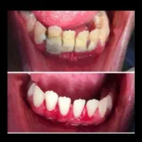 کلیه خدمات دندانپزشکی مناسب همه|خدمات آرایشگری و زیبایی|کرمانشاه, |دیوار