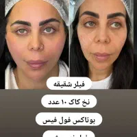 اموزش فیلر و بوتاکس پی ار پی .مزوتراپی|خدمات آموزشی|کرمانشاه, |دیوار