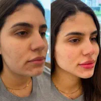 کلینیک تزریق ژل و بوتاکس .فیلر زیر چشم . آنزیم|خدمات آرایشگری و زیبایی|کرج, گوهردشت|دیوار