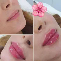 تزریق فول فیس صورت،فیلر لب وزاویه سازی|خدمات آرایشگری و زیبایی|شیراز, شهرک ایثار|دیوار