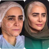 تخفیفات باورنکردنی خدمات زیبایی