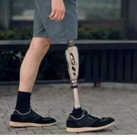 کلینیک تخصصی ساخت پروتز پیشرفته پای مصنوعی|خدمات آرایشگری و زیبایی|رزن, |دیوار