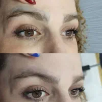 تخفیفات پاککردن تتو صورت وبدن|خدمات زیبایی و سلامت|کرمانشاه, |دیوار