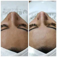 فیشال وپاکسازی.درما.پلاژن .کربوکسی.اسید تراپی|خدمات آرایشگری و زیبایی|مشهد, کوی سیدی|دیوار