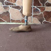 پای مصنوعی