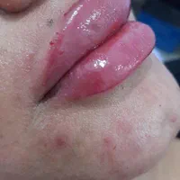 زیبایی صورت و بدن|خدمات آرایشگری و زیبایی|اهواز, نادری|دیوار