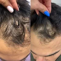فقط کافیه بخوای موهات در بیاد بقیش با من