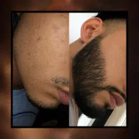 حراجی پنجاه درصدی