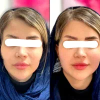 پک زیبایی جوانه گندم