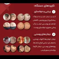 بهترین جوانساز پوست چین چروک لیفت درمان زخم لاغری|پزشکی|کرمانشاه, |دیوار