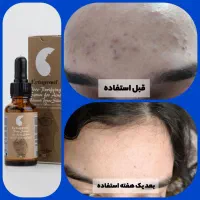 «پوستت رو متحول کن »|خدمات آرایشگری و زیبایی|کرج, دولت‌آباد|دیوار