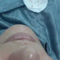 فیشیال وپاکسازی پوست ویژه بانوان|خدمات آرایشگری و زیبایی|سقز, |دیوار