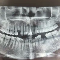 دستیار با تجربه و کاربلد دندانپزشکی