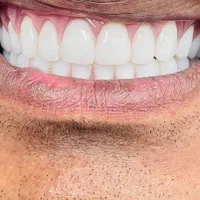 دندانپزشکی و کامپوزیت دندان و دندان مصنوعی|خدمات آرایشگری و زیبایی|تهران, بهداشت|دیوار