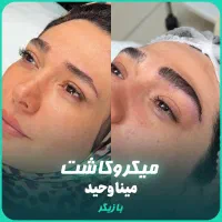 زیبایی ابرو کاشت ابرو نچرال