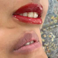 لیپ بلاش روسی و ریمو تتو