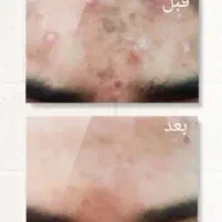 روغن های تخصصی|عمدهفروشی|زاهدان, |دیوار