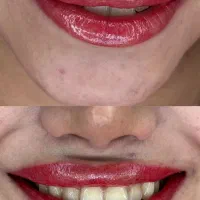 بلک فرایدی ۵۰٪|خدمات آرایشگری و زیبایی|تربت‌حیدریه, مظفریه|دیوار