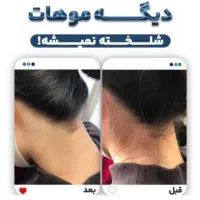 آموزش مرکز لیزر مو طول موج کندلا لیزر بانوان لیزر|خدمات آموزشی|اصفهان, خواجو|دیوار