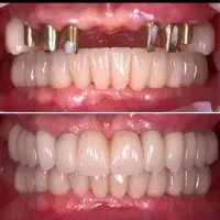 دندان پزشکی زهره (جیحون)