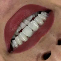 دعوت به همکاری از دندانپزشک