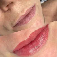 فیبروز، سایه ابرو، شیدلینگ لب