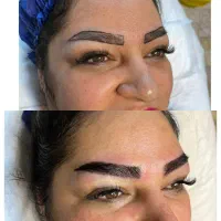 جشنواره کاشت ابرو-میکروکاشت-کاشت مو-کاشت شقیقه