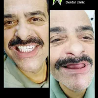 ایمپلنت مرکزی شیراز با متخصصین دکتر دانشور|خدمات آرایشگری و زیبایی|شیراز, معالی‌آباد|دیوار