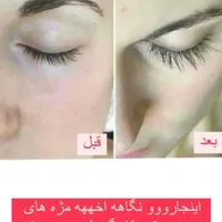 تقویت مژه|آرایشی، بهداشتی، درمانی|رشت, کوی جام جم|دیوار