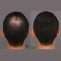 اسکالپ سر و فیبروز ابرو|خدمات آرایشگری و زیبایی|شیراز, ملاصدرا|دیوار