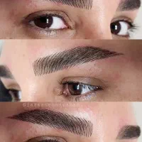 با یک میلیون میکروبلیدینگ انجام بده  نه ۵میلیون