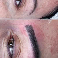 کاشت ابرو نچرال و حرفه ایی