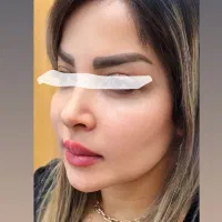 تزریق چربی به تمام نواحی|خدمات آرایشگری و زیبایی|قزوین, |دیوار