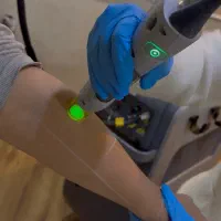 لیزر موهای زائد (کندلا ۲۰۲۳) برای آقایون و خانم ها