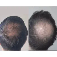 ۳۰ روز استفاده یک عمر نتیجه