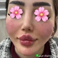 اف ویژه ژل 550تا دوروز برند اودری ام کار تضمینی