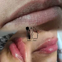 تزریق ژل و بوتاکس|خدمات آرایشگری و زیبایی|جهرم, |دیوار