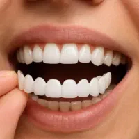 لمینت مترحک دندان|آرایشی، بهداشتی، درمانی|اهواز, آریاشهر|دیوار