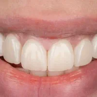 دندانپزشکی (درمانی و زیبایی، اطفال و بزرگسال)