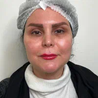 تزریق چربی صورت دست با سن بیکینی در کلینیک تخصصی|خدمات آرایشگری و زیبایی|تهران, صادقیه|دیوار