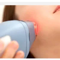 لیزر موهای زائد با تخفیف تابستانه