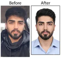 عکس فوری 8 عدد 250 ت