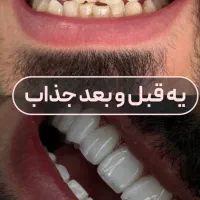 جشنواره کامپوزیت از ۵۹۰|خدمات آرایشگری و زیبایی|اهواز, کیانپارس |دیوار